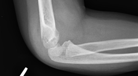 Capture d’écran 2019-02-10 à 17.59.39